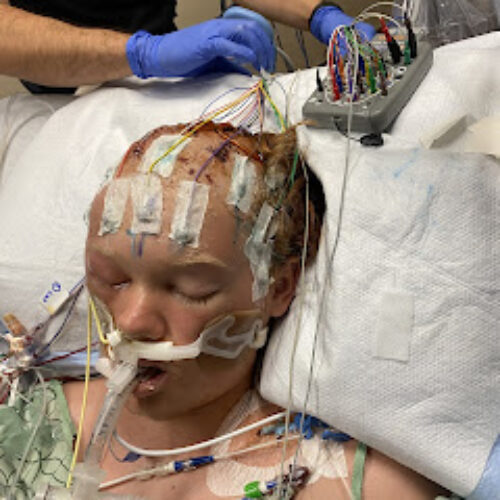 Neurofeedback